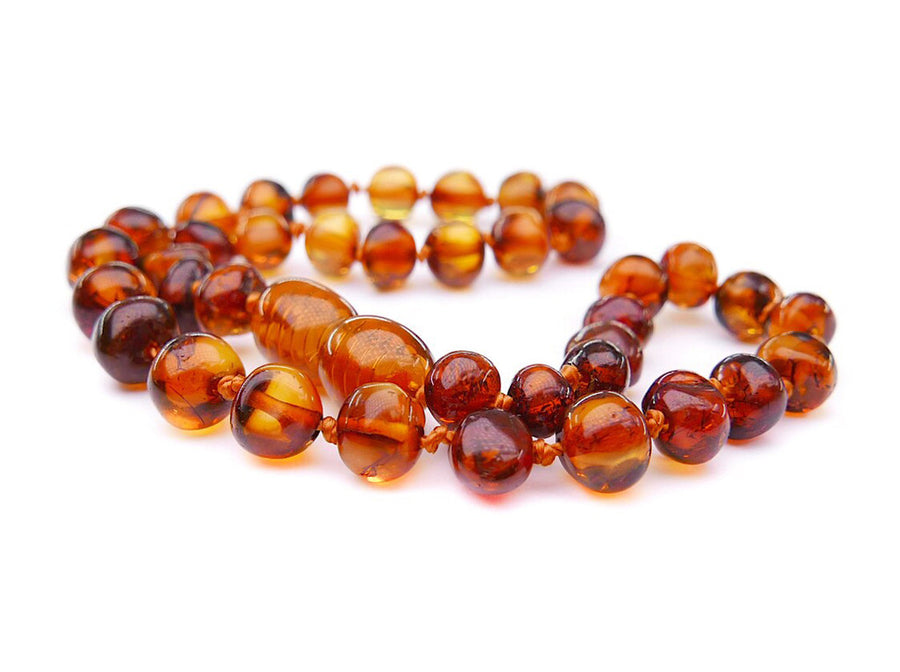 POLISHED COGNAC BALTIC AMBER ADULT ANKLET