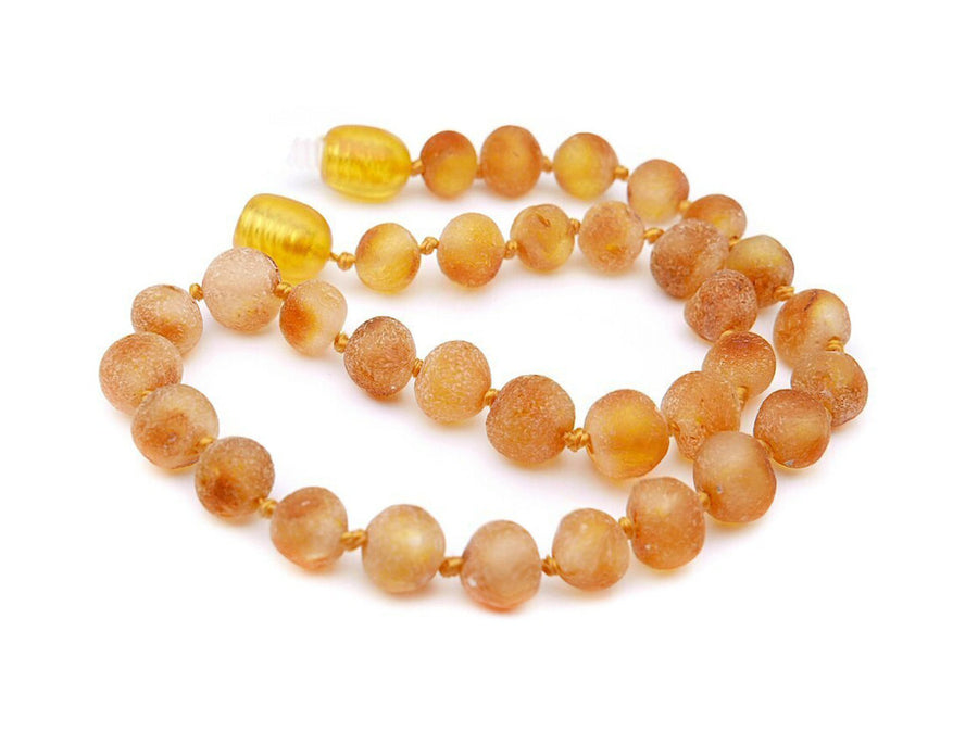 RAW HONEY BALTIC AMBER ADULT ANKLET