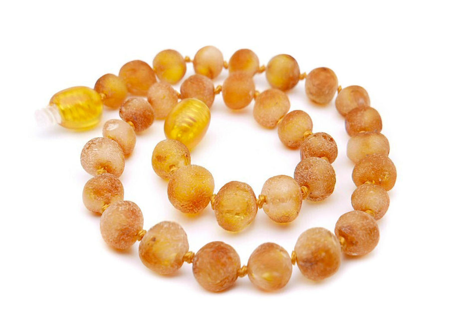 RAW HONEY BALTIC AMBER ADULT ANKLET