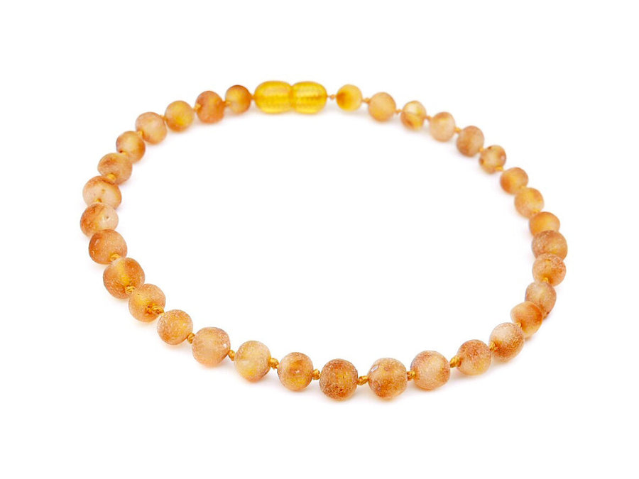 RAW HONEY BALTIC AMBER ADULT ANKLET