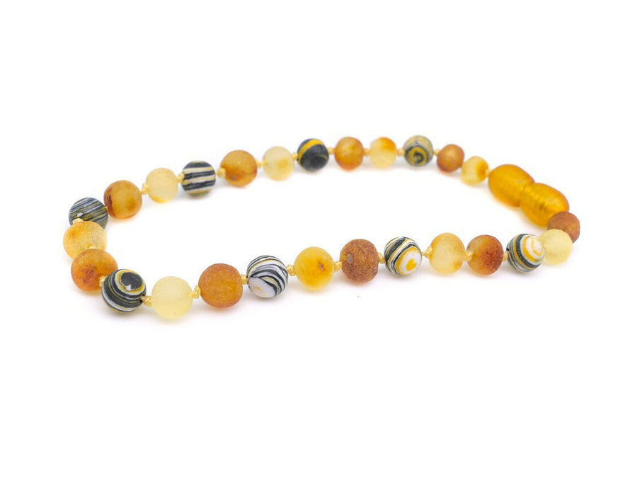 BALTIC AMBER HEALING BRACELET WITH YELLOW MALACHITE