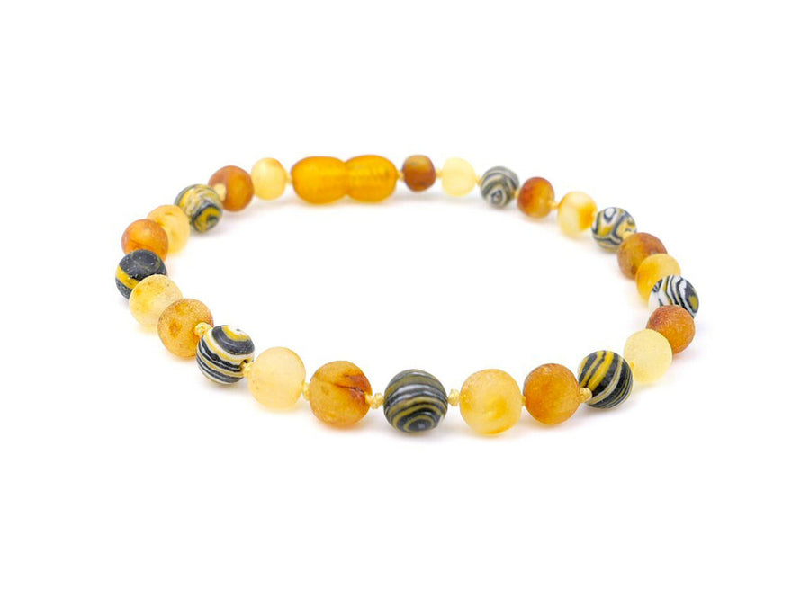 BALTIC AMBER HEALING BRACELET WITH YELLOW MALACHITE