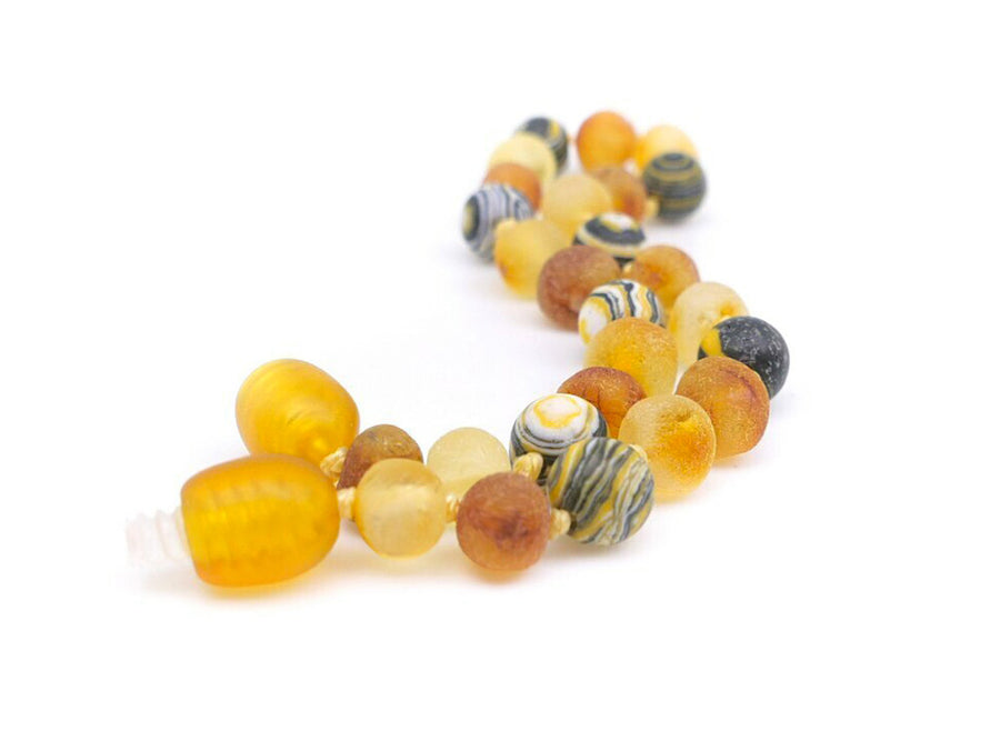 BALTIC AMBER HEALING BRACELET WITH YELLOW MALACHITE