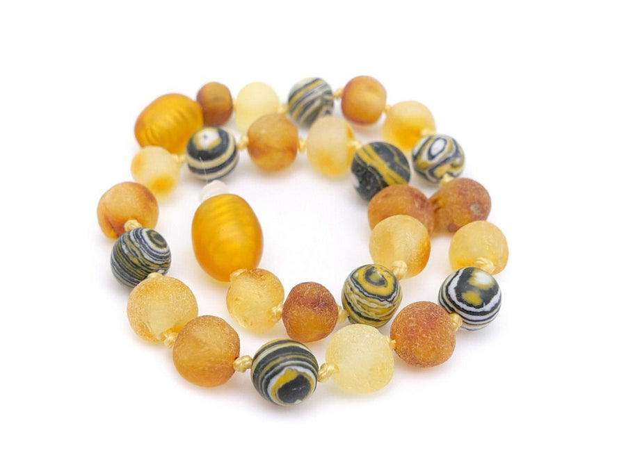 BALTIC AMBER HEALING BRACELET WITH YELLOW MALACHITE