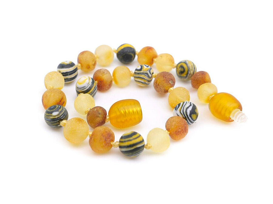 BALTIC AMBER HEALING BRACELET WITH YELLOW MALACHITE