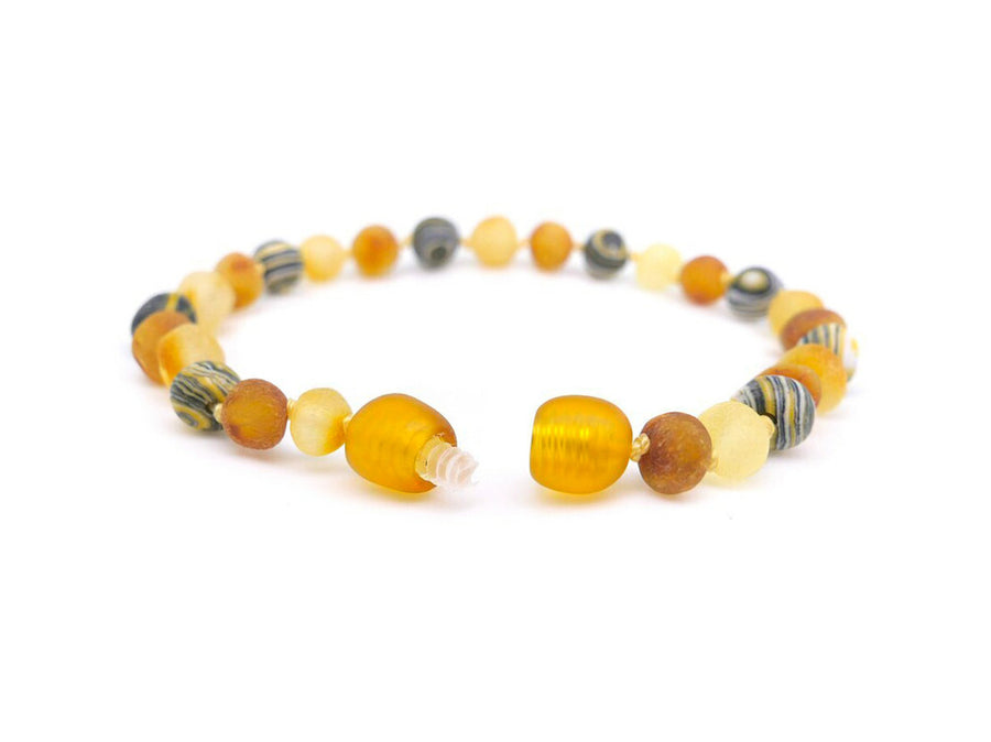 BALTIC AMBER HEALING BRACELET WITH YELLOW MALACHITE