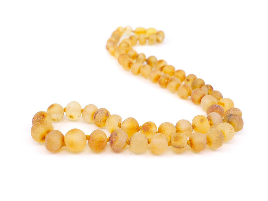 RAW HONEY ADULT BALTIC AMBER NECKLACE